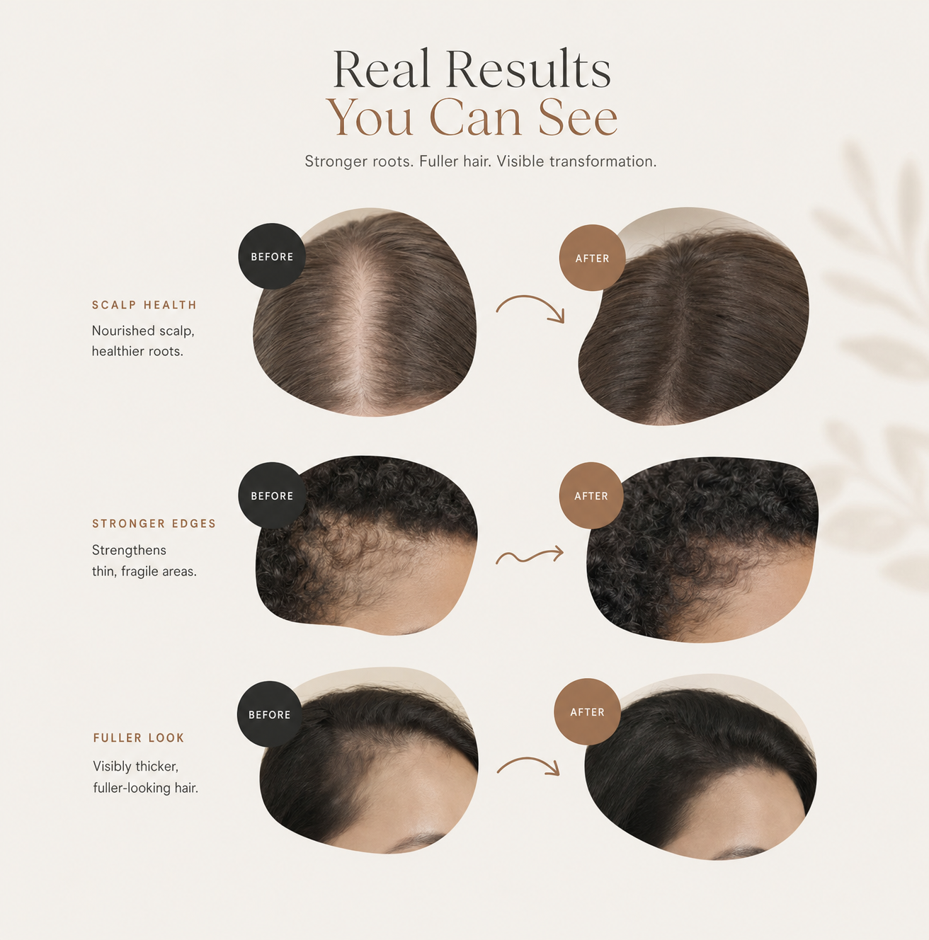 Korean Hair Growth Serum for Thinning & Shedding